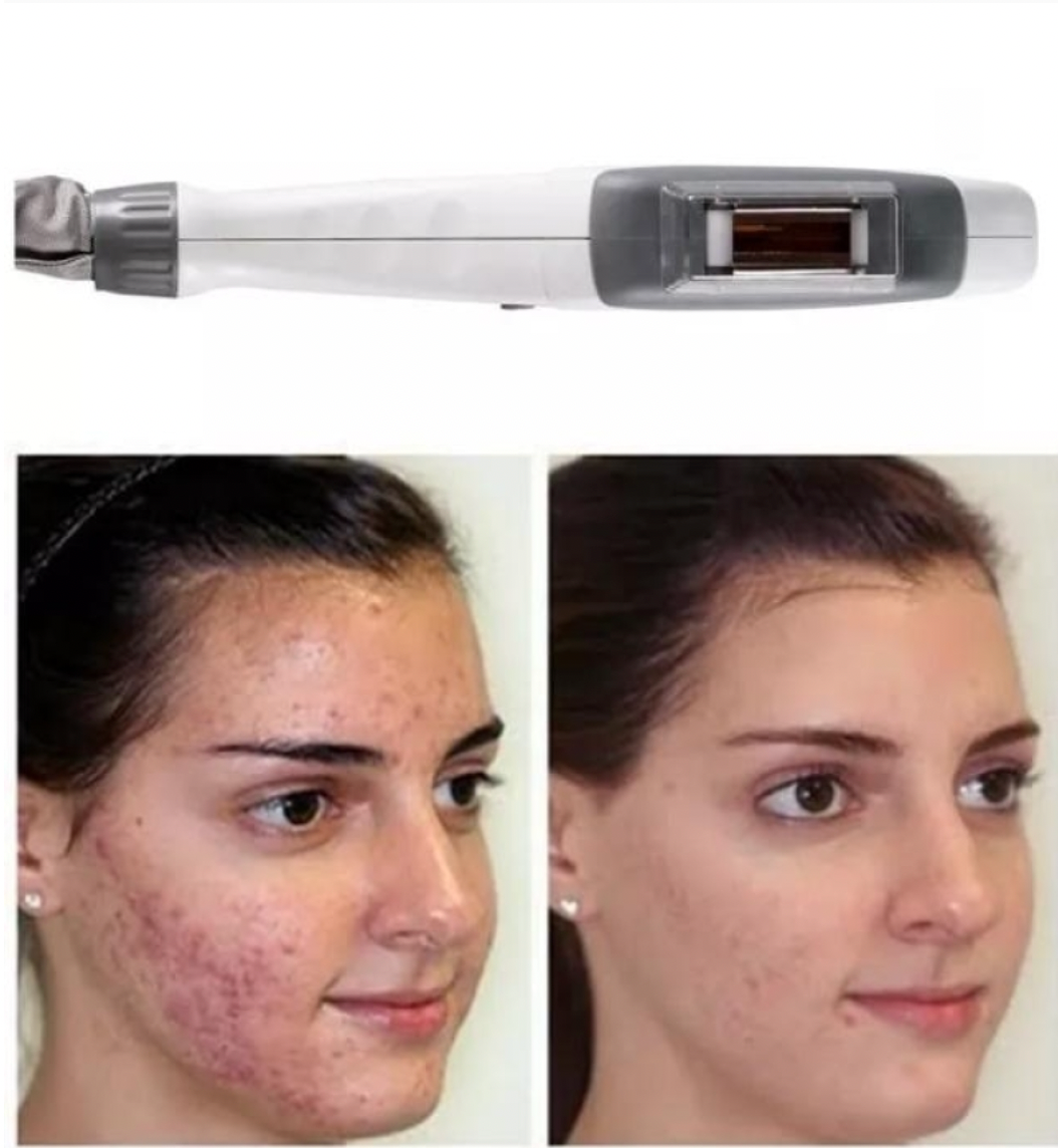 Zemits Light Expert 2.0 IPL laserový přístroj