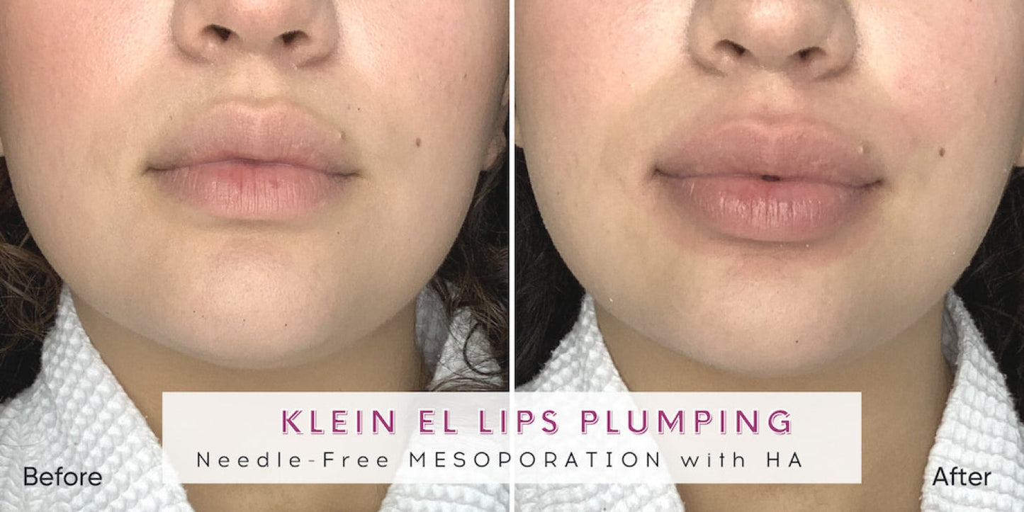 Zemits Klein EL Elektroporační systém