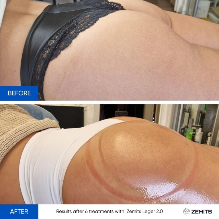 Zemits Leger 2.0 vakuový baňkovací systém s XXL šálky v sadě