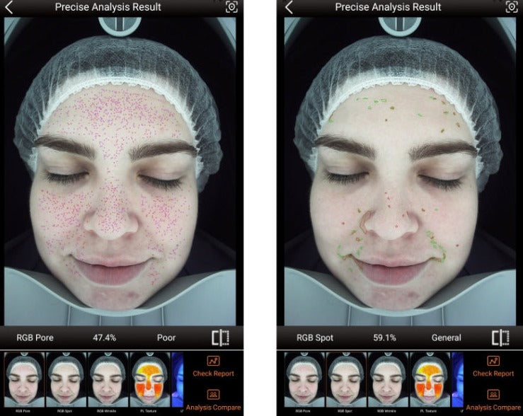 Zemits VeraFace Systém pro analýzu pleti