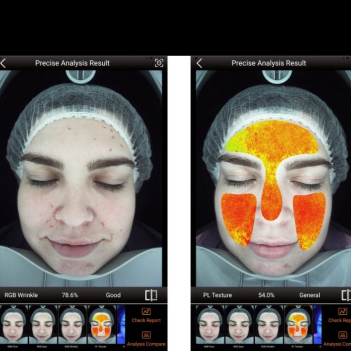 Zemits VeraFace Systém pro analýzu pleti