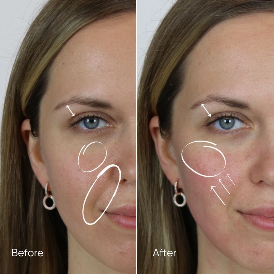 Zemits HydroVerstand PRO 7-v-1 HydroDiamond™ Systém